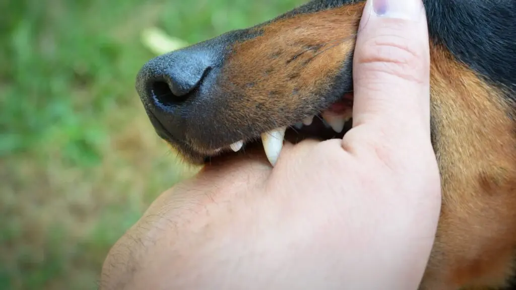 Close-up of documented dog bite wounds used as evidence in a legal claim.